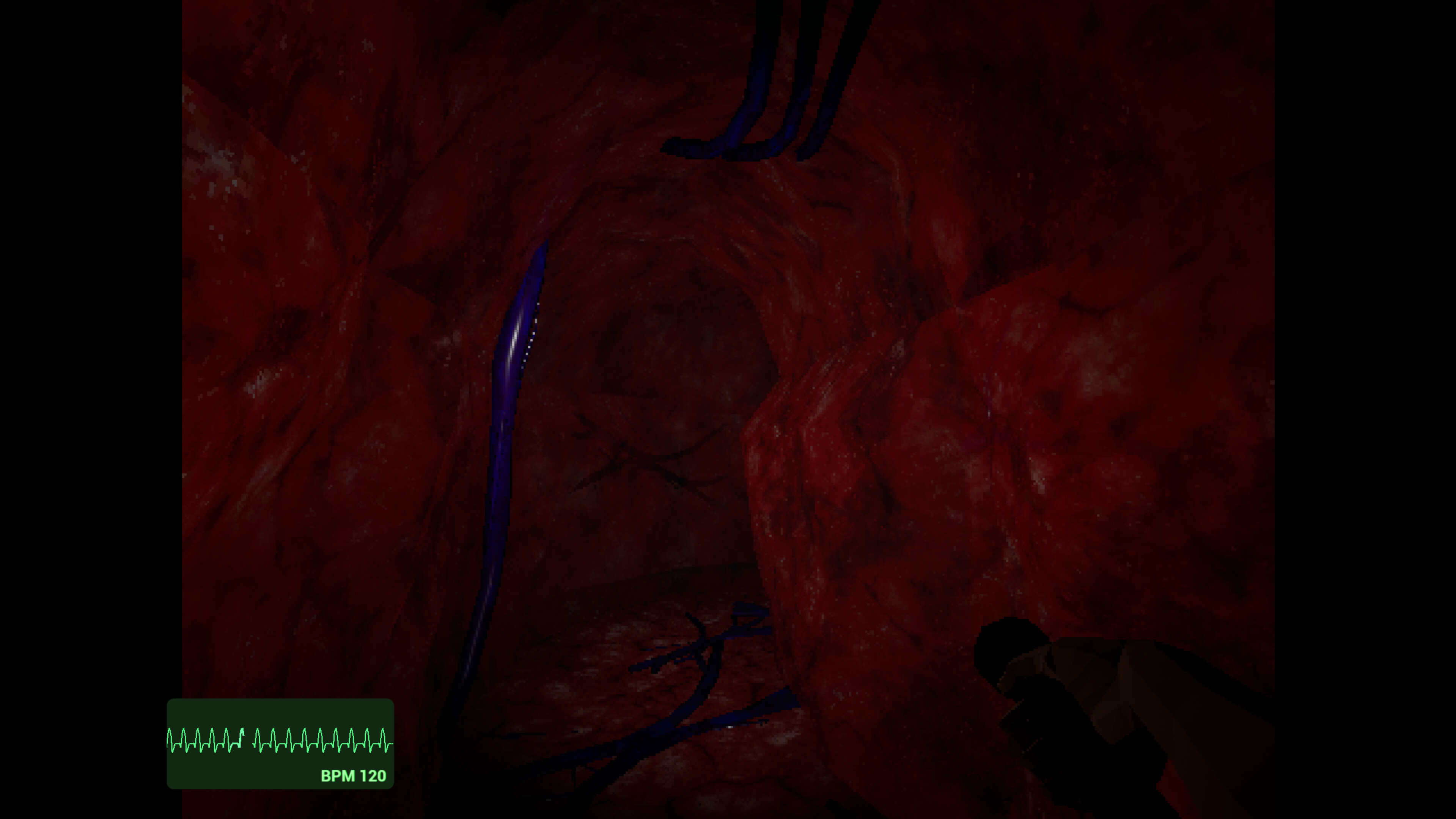 Cabin Heart screenshot 4