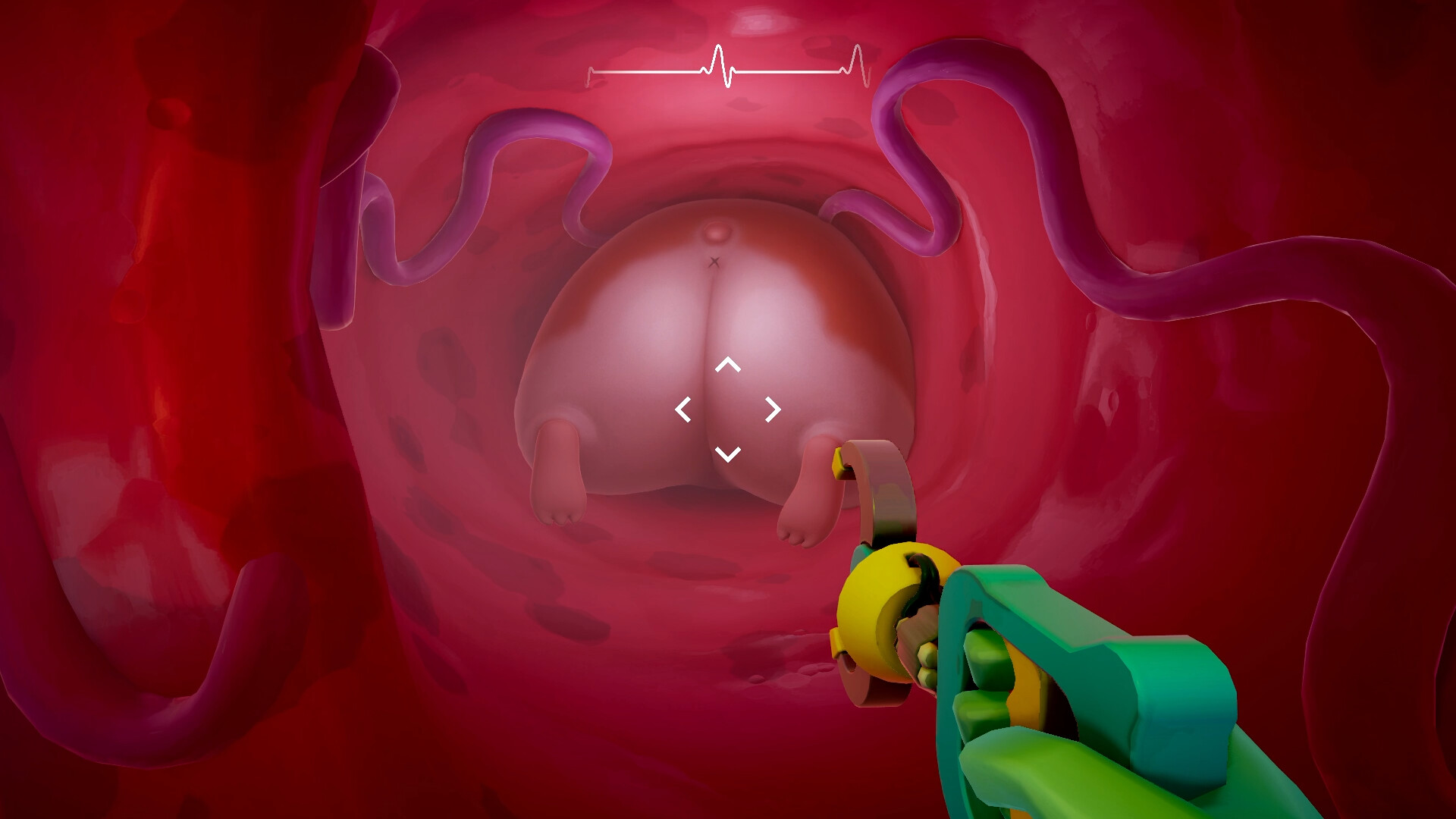Crack Surgeons 🍑 screenshot 2